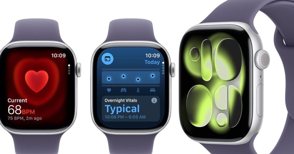 Heads up: Silver Apple Watch Series 11 cell model just hit the best price ever at 9 off Heads up: Silver Apple Watch Series 11 cell model just hit the best price ever at 9 off