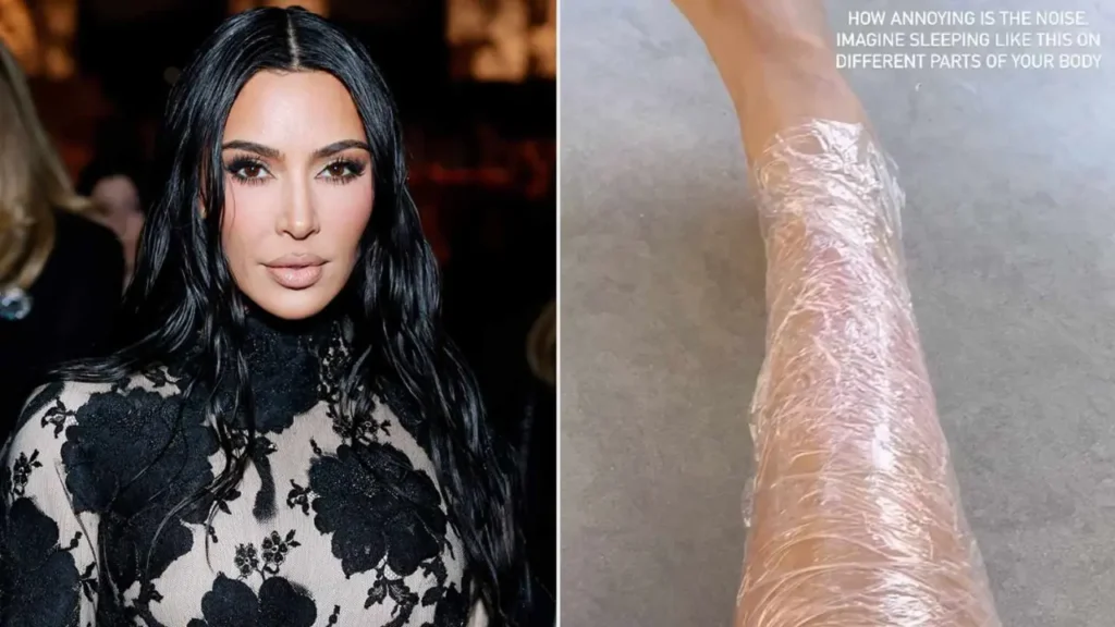 Kim Kardashian opens up about psoriasis battle: ‘It definitely made me insecure’