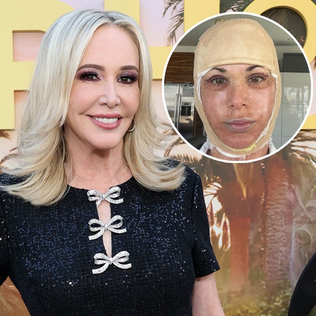 RHOC’s Shannon Beador Hilariously Shades Alexis Bellino After Facelift Reveal