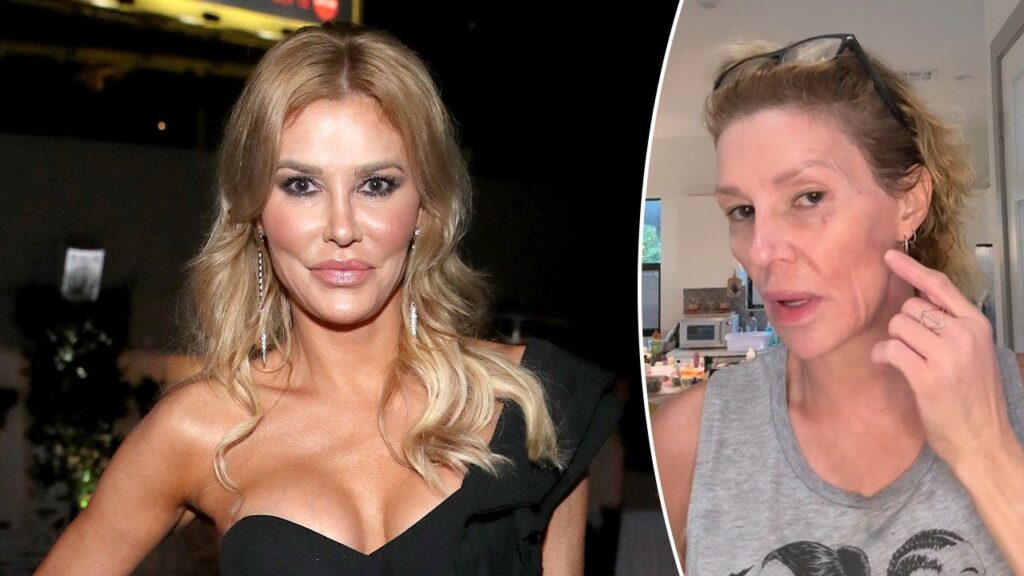 Brandi Glanville speaks out on complex diagnosis and K monthly medical battle