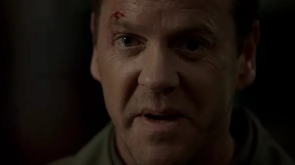 Jack Bauer (Kiefer Sutherland) has a small cut on his temple, looking intense, likely in a dramatic scene