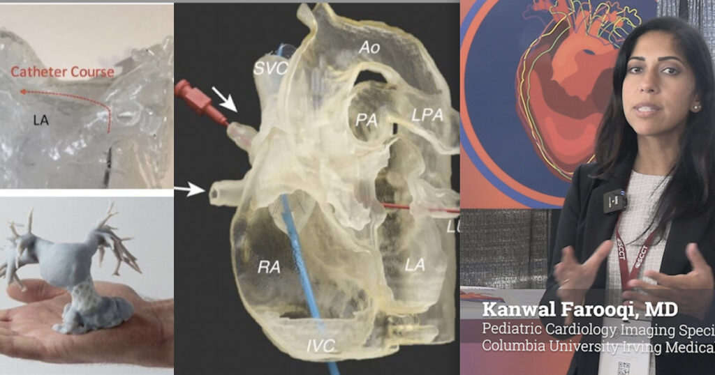 3D printing, VR playing a major role in congenital heart imaging 3D printing, VR playing a major role in congenital heart imaging